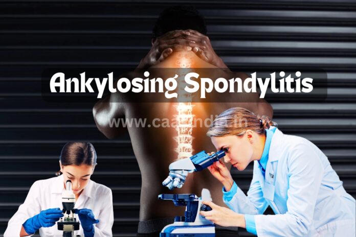 Ankylosing Spondylitis Treatment : जानिए किन दशों में चल रही है प्रभावी दवा की खोज