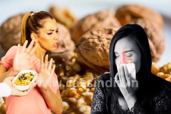 Nut Allergies : क्यों होती है नट्स एलर्जी, क्या है इसका उपचार 