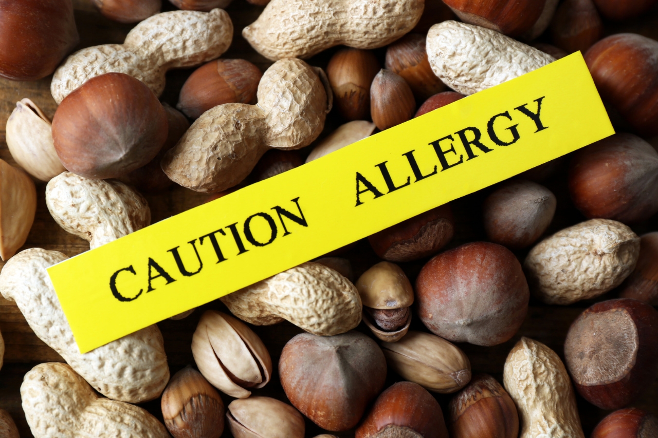 Nut Allergies : क्यों होती है नट्स एलर्जी, क्या है इसका उपचार 